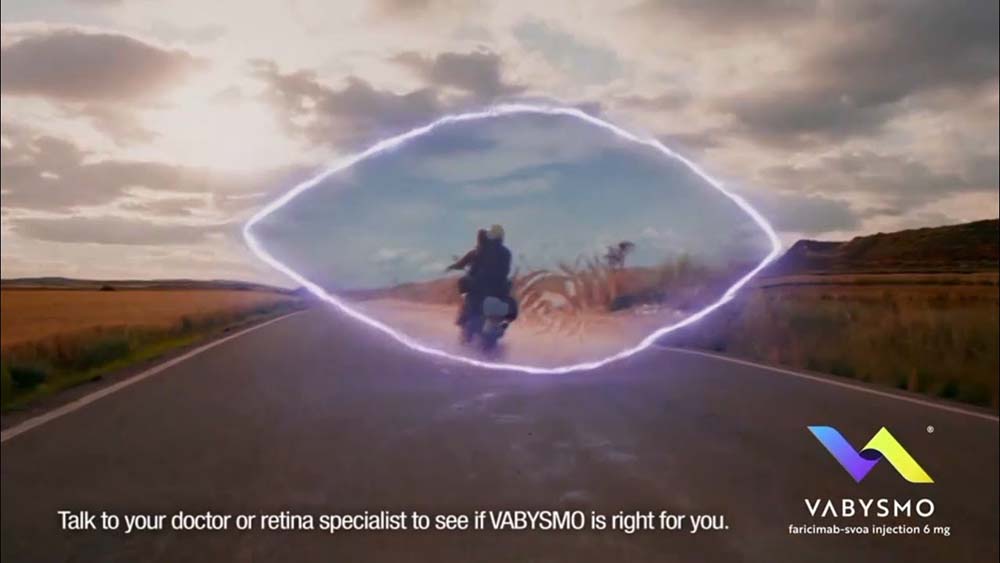 CP WORKS – VABYSMO